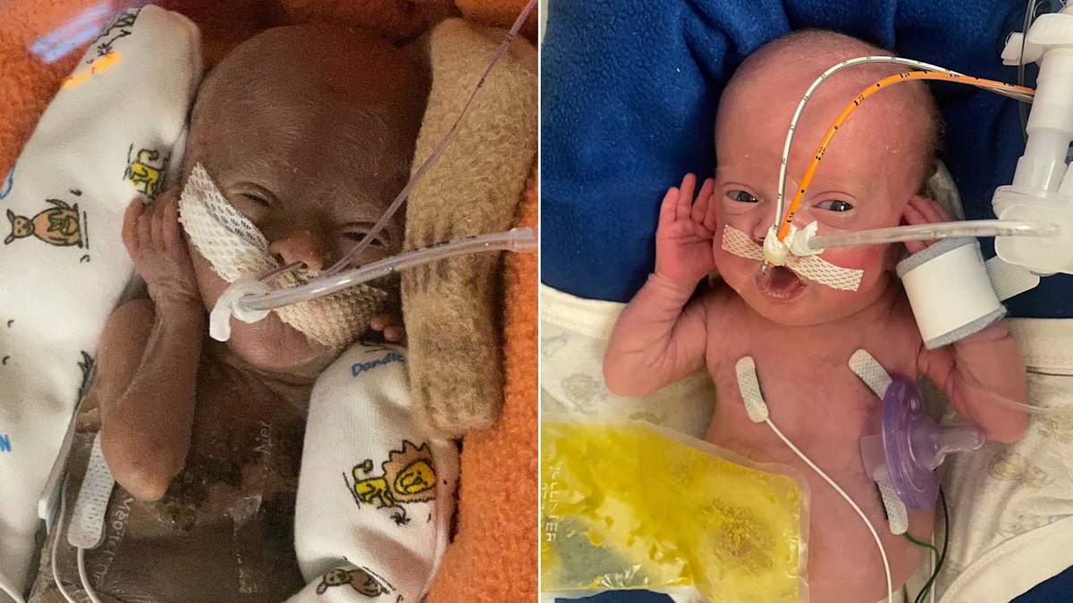 Nash Keen - 3 weeks and 14 weeks