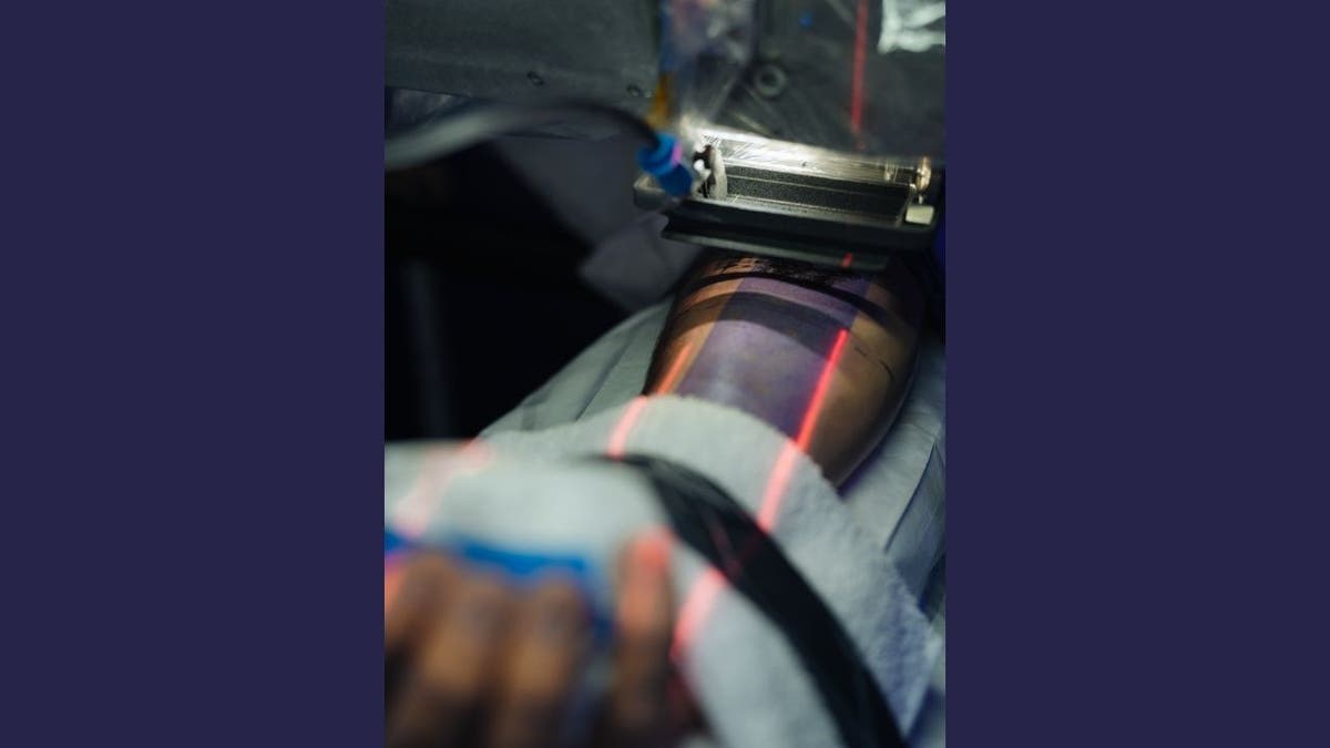 AI tattoo machine (Blackdot)