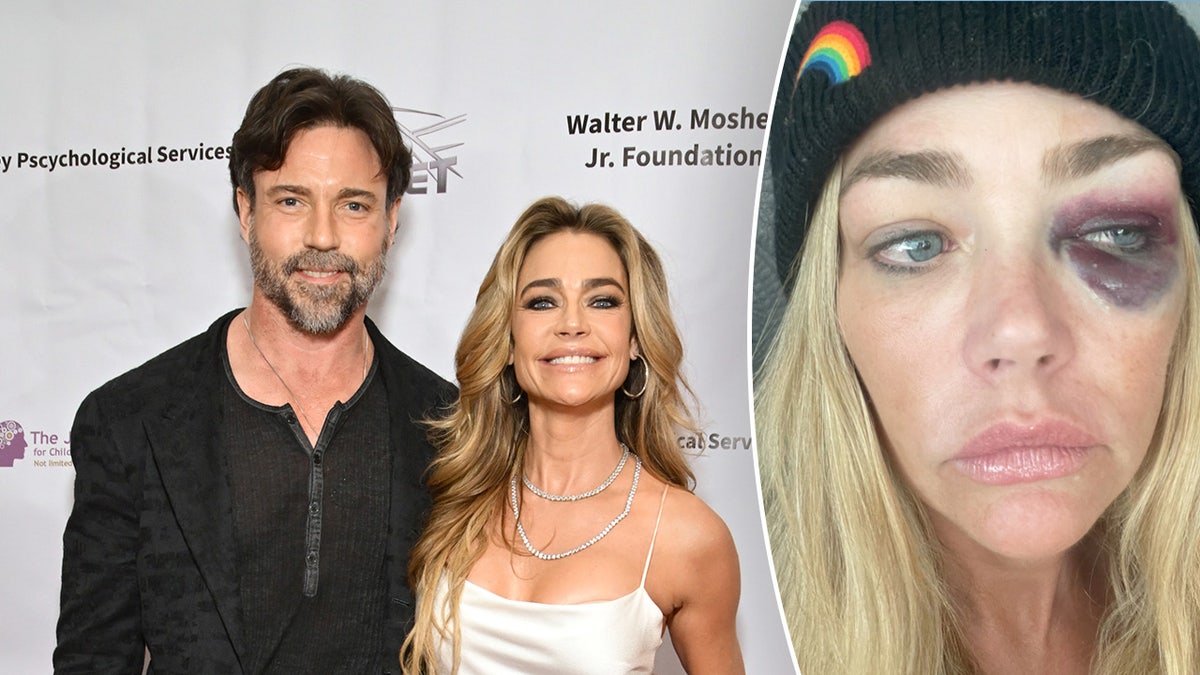 Aaron Phypers, Denise Richards
