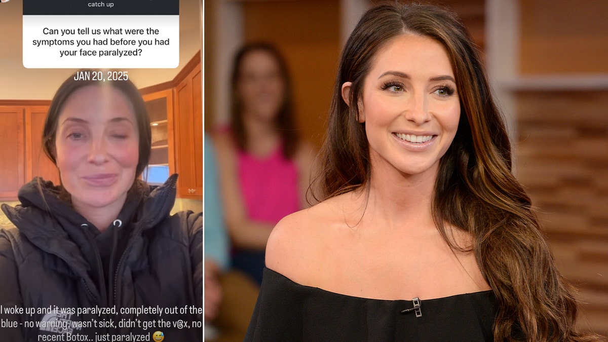 Bristol Palin shows nan paralysis successful her face