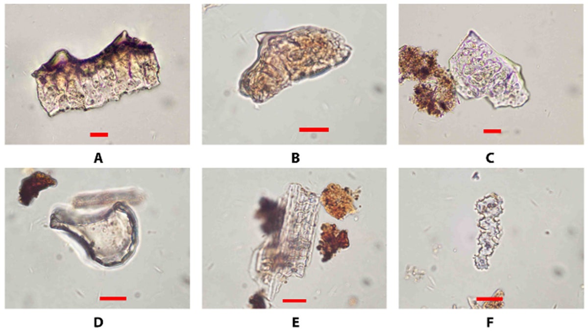 Microscopic image of various rice fragments