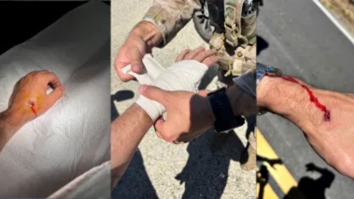 Injuries sustained by an ICE employee recently