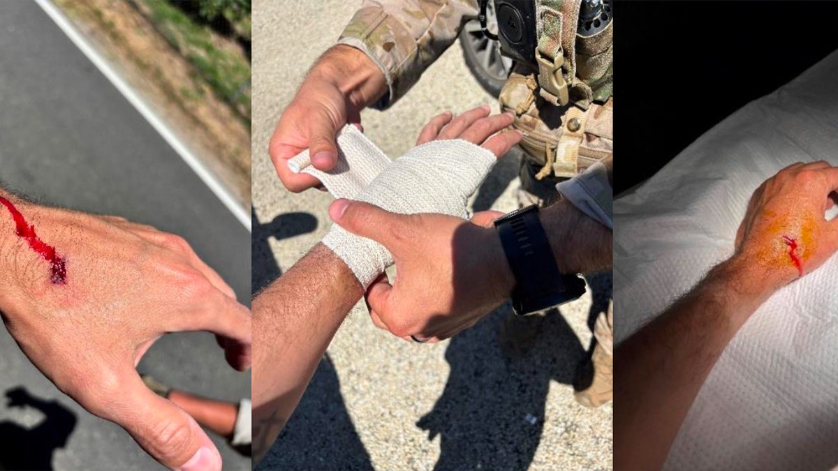 An ICE employee's hand was injured during the riot