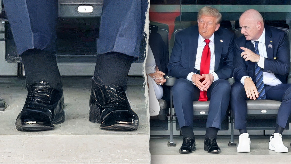 President Trump swollen ankles
