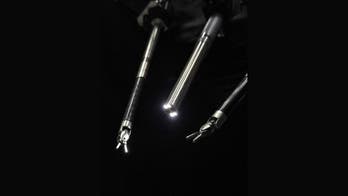AI robot performs gallbladder surgery autonomously