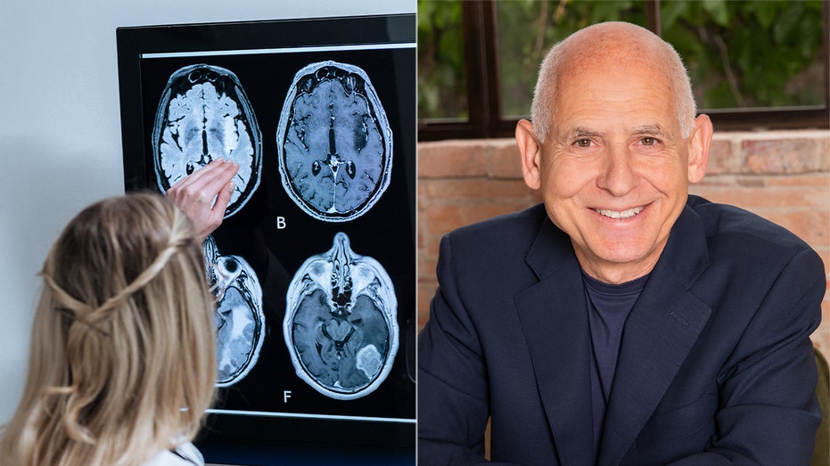 Making these 11 lifestyle changes could ward off Alzheimer's, expert says