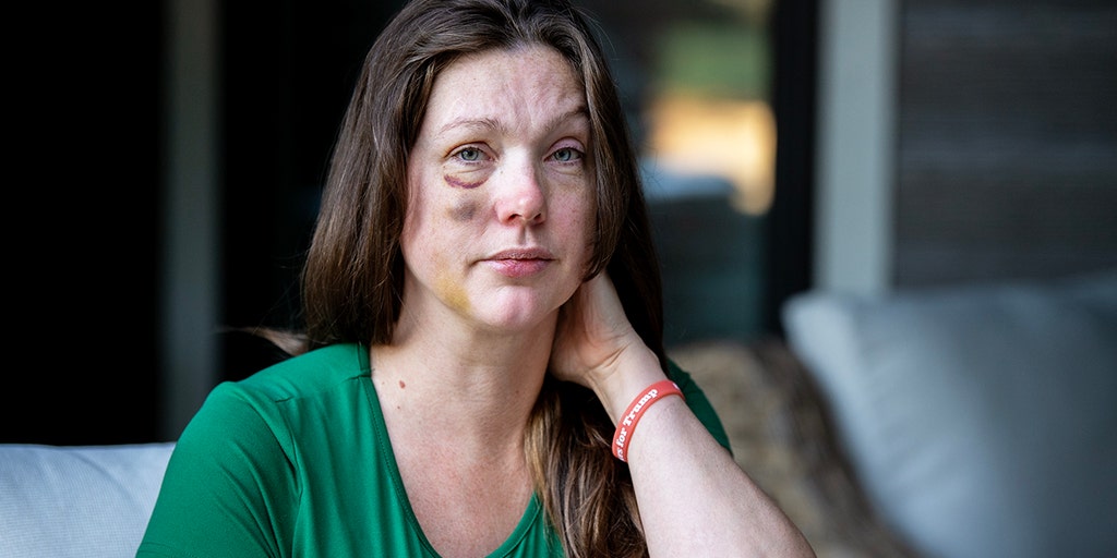 Cincinnati woman speaks out after being beaten for helping attack victim |  Fox News