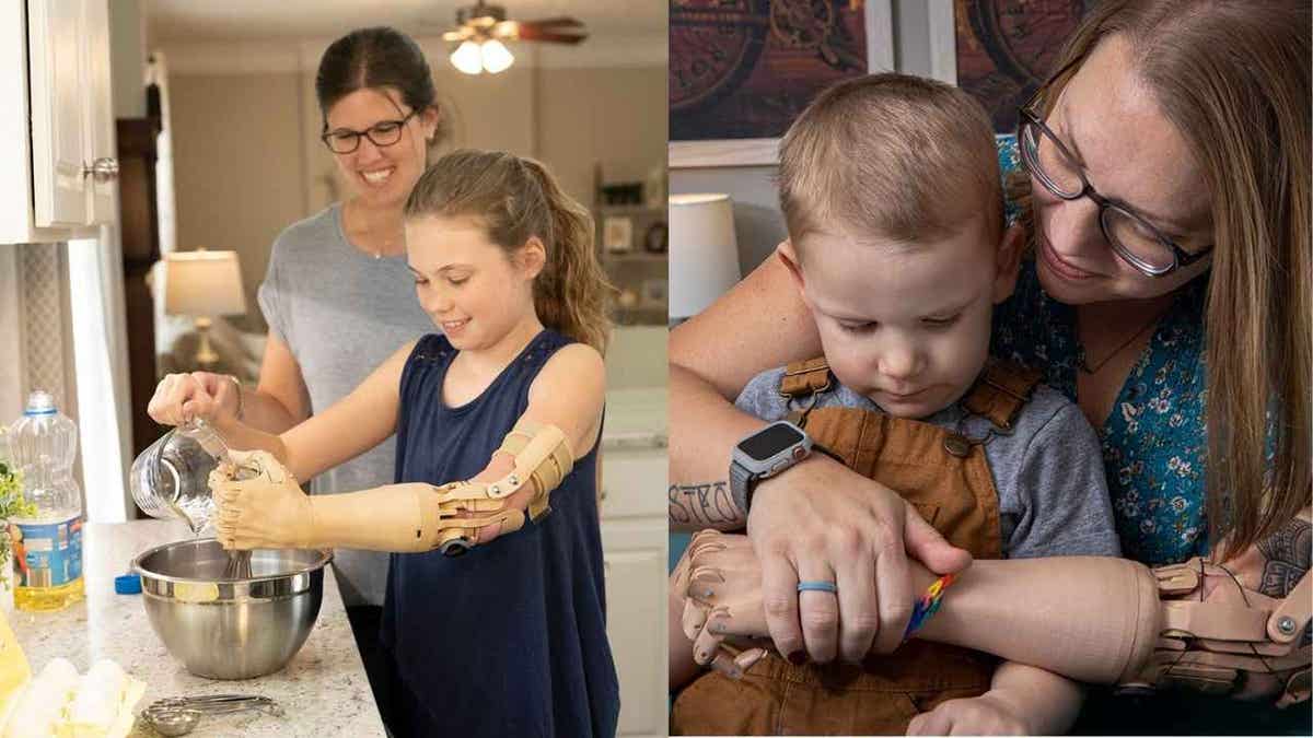 bionic arm 1