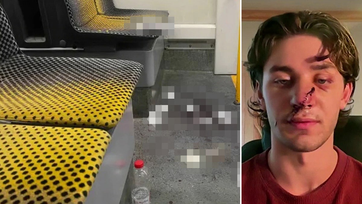 American stabbed defending women on German tram criticizes immigration policies after suspect released