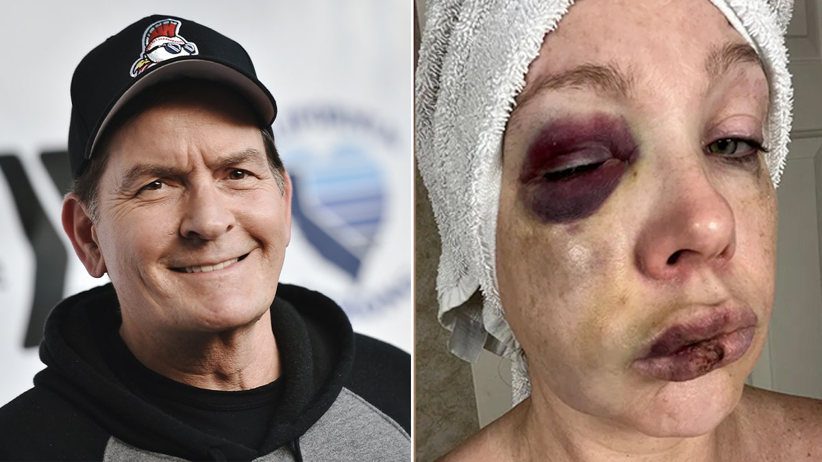 Charlie Sheen (L) and Holly (R)
