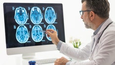 Aging brains could 'become' younger when key protein is decreased