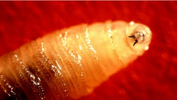 Flesh-eating parasite case detected in US traveler returning from Central America
