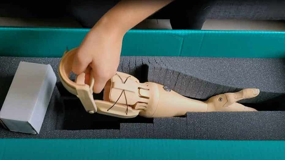 Affordable 3D-printed bionic arm uses muscle signals to move