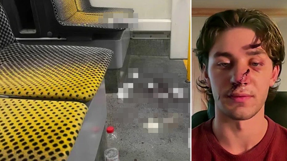 American stabbed defending women on German tram criticizes immigration policies after suspect released