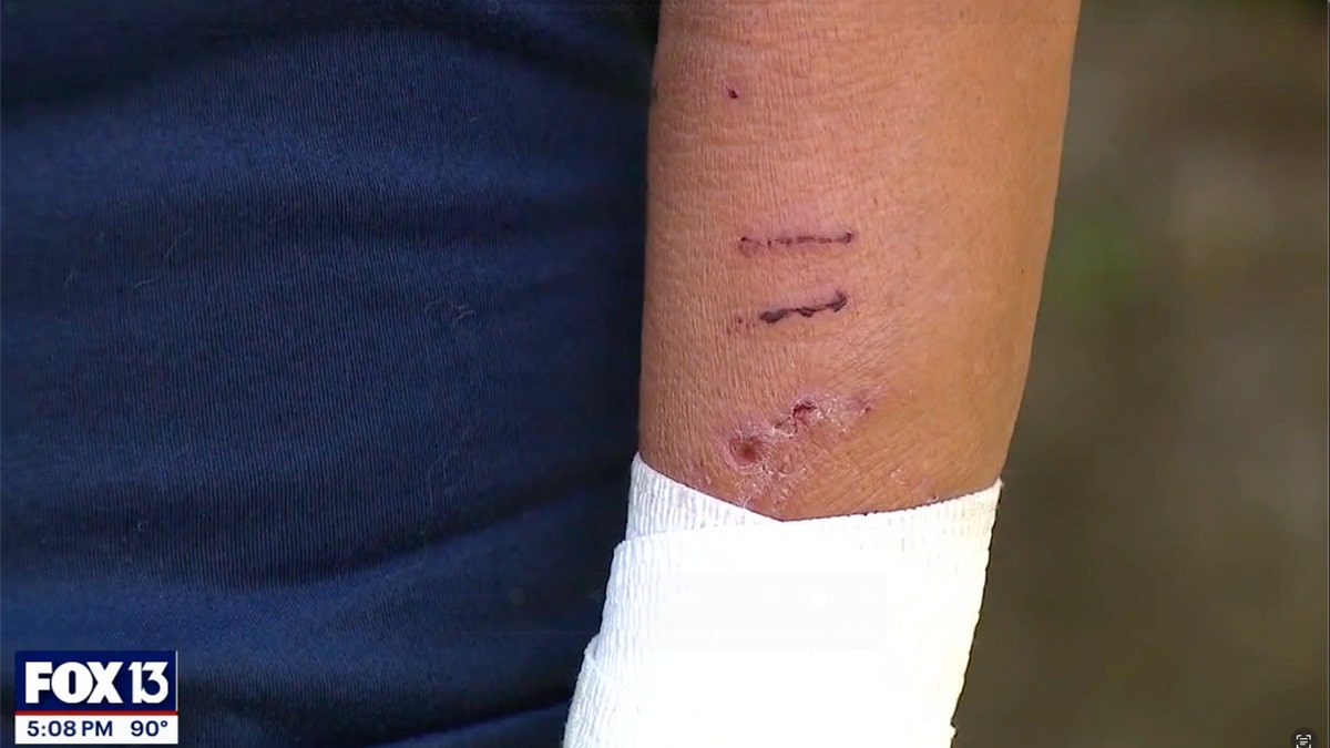 Scratches on dog owner's arm