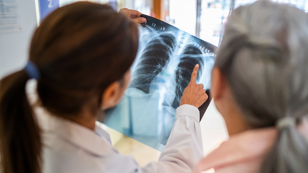 The doctor and the patient look at X -rays on the chest