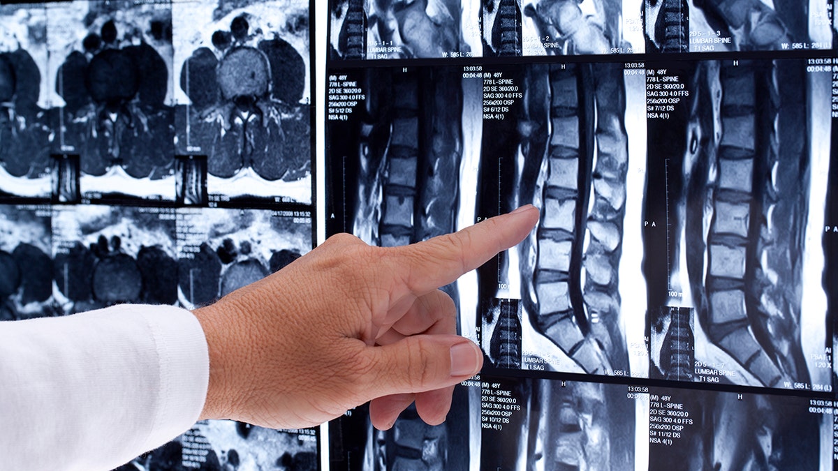 human spine scan