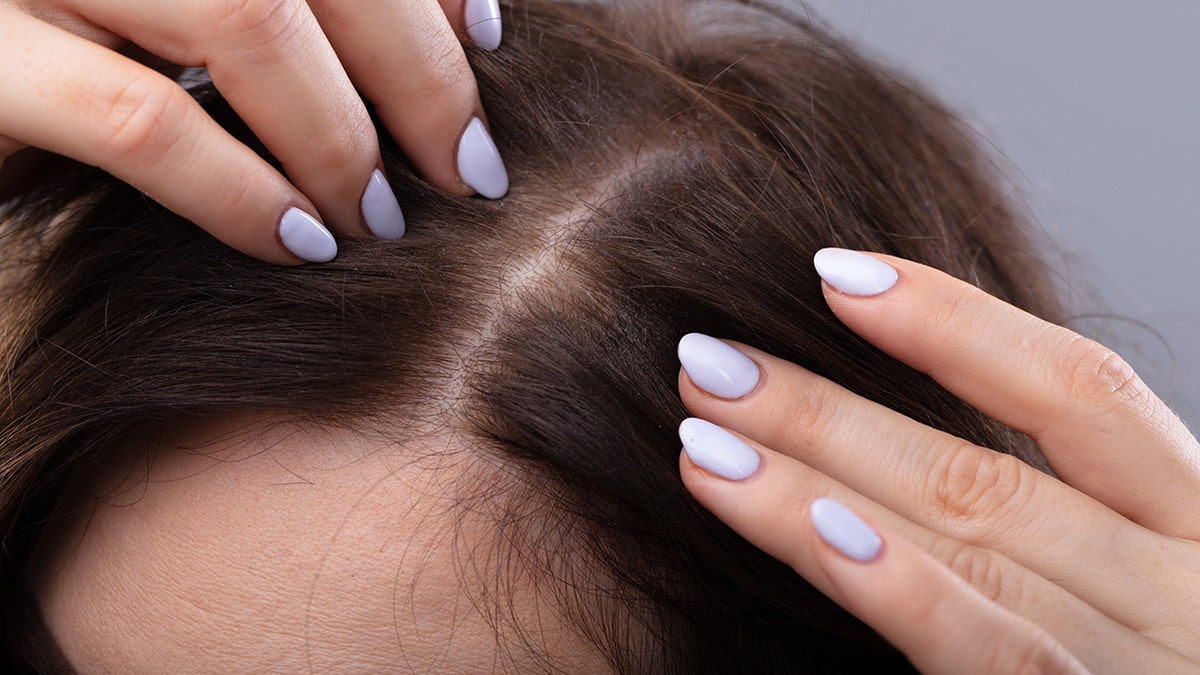 Up close view of womans fingernails near scalp as she examines thinning hair long her part
