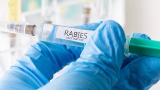 11-year-old dies from rabies after bat landed on his face while he was sleeping