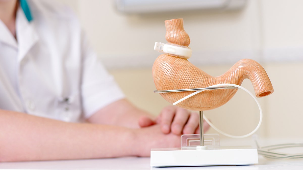 Lap-Band placed on a replica stomach.