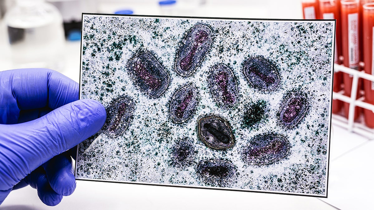 pharmacist's hand with latex glove holding photo of monkeypox virus