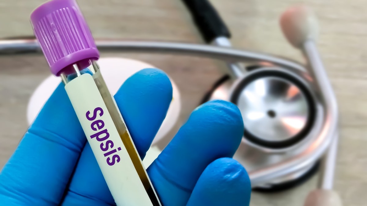 Sepsis's blood test