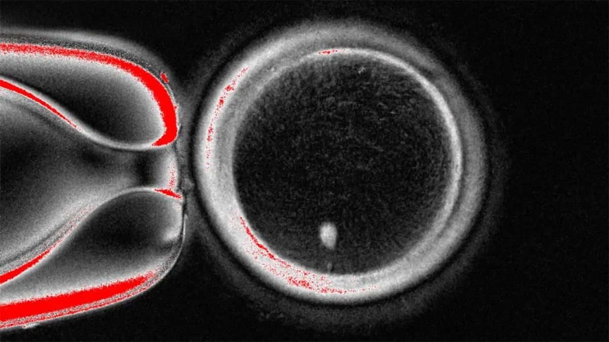 skin cell and egg