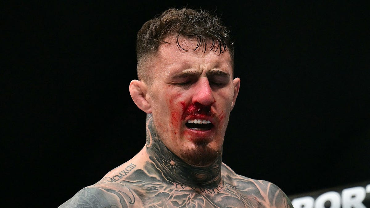 Tom Aspinall bloodied