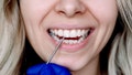 Researchers say human hair could soon be key to repairing teeth damaged by cavities - Fox News