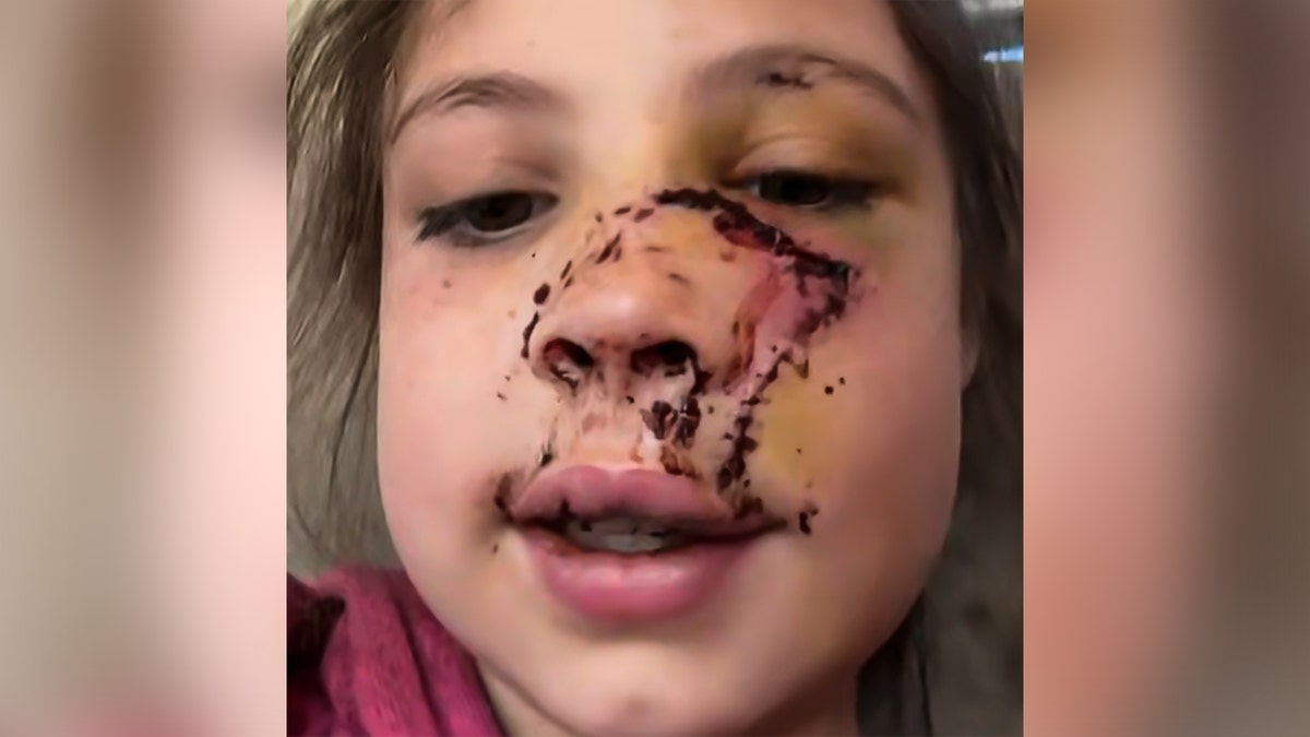 Delyla McCay's verwondingen.