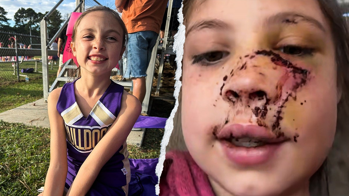 A 9-year-old miss was attacked by a bluish heeler.