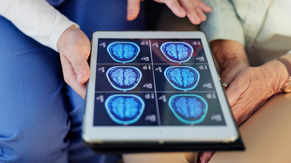 ডাক্তার এবং রোগীর মস্তিষ্কের স্ক্যান