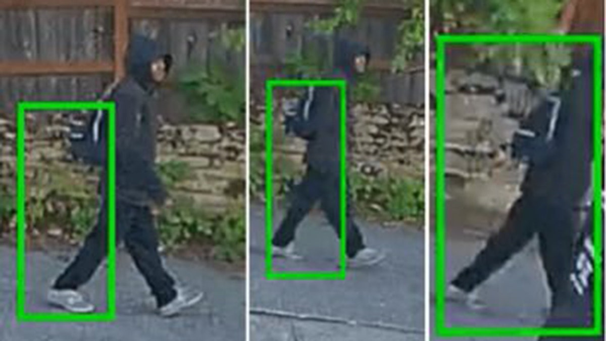 An 88-year-old Seattle woman was hospitalized with serious head injuries after a man brutally assaulted and robbed her outside her home, stealing her jewelry and biting off her finger, authorities say.