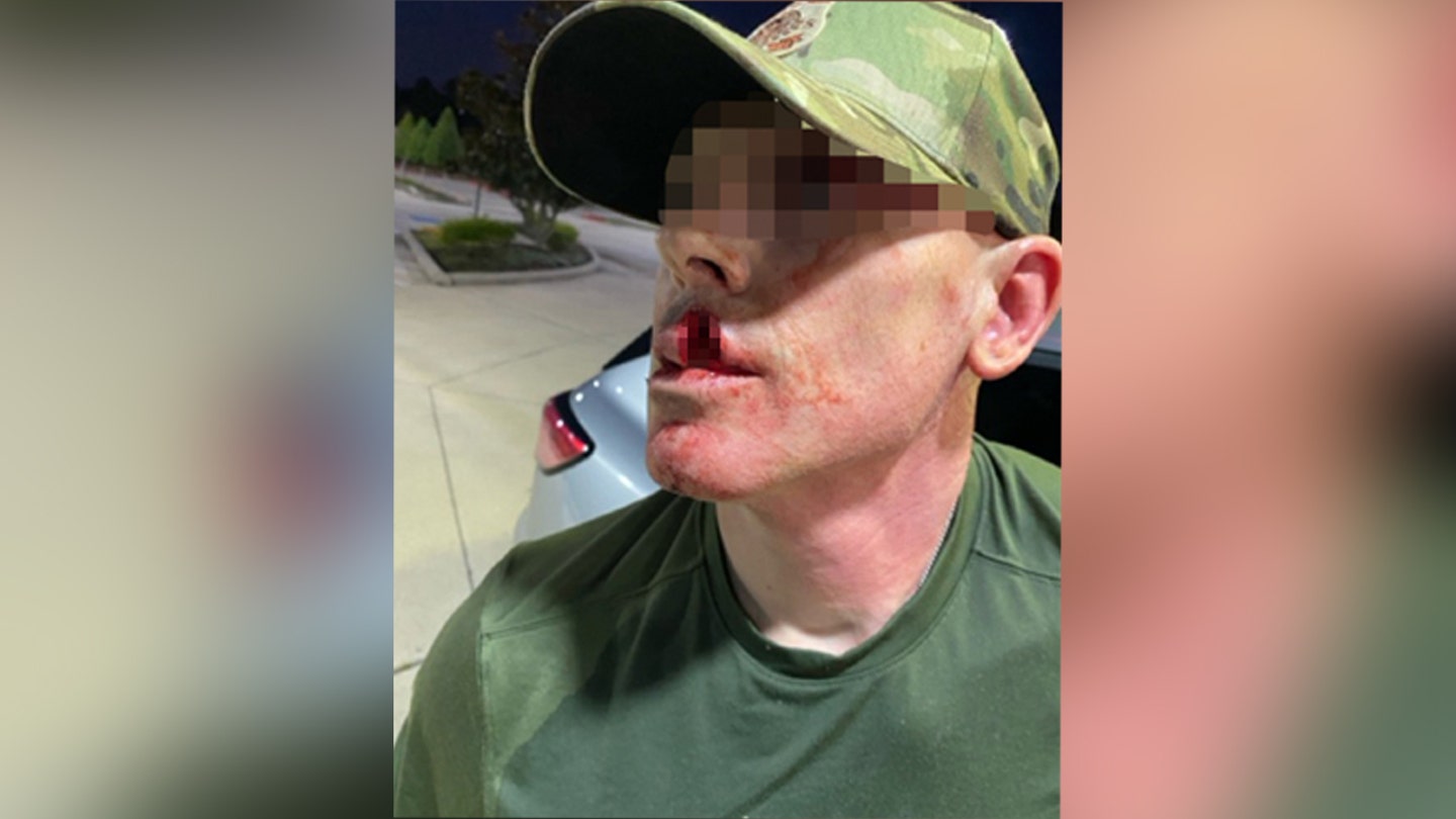 ICE agent required 13 stitches after being struck in the face with a metal object