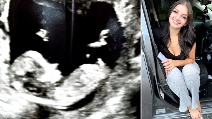 Titulares principales de Fox News para el 3 de noviembre