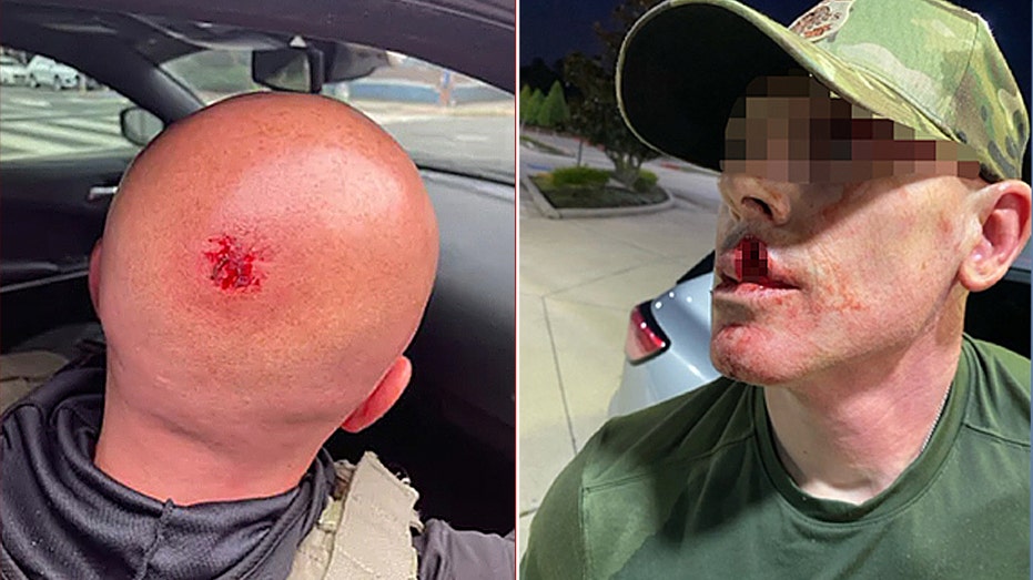 ICE AGENTS UNDER ATTACK: Sanctuary City Policies Fuel 1150% VIOLENCE SPIKE!