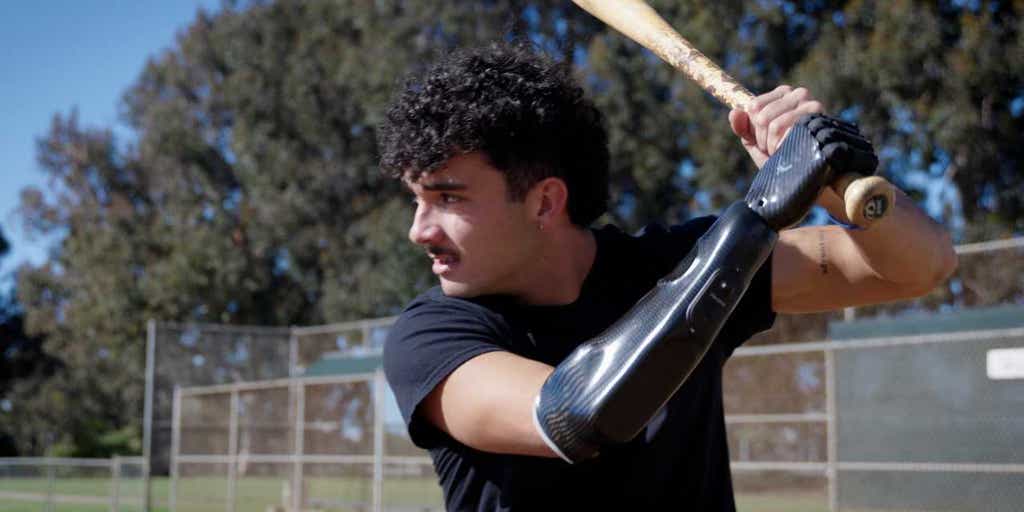 Bionic hand brings baseball star back to the field