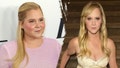 What to know about Cushing&rsquo;s syndrome, which led to Amy Schumer&apos;s dramatic weight loss - Fox News