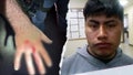Illegal immigrant bites ICE officer in &apos;gross attack&apos; while resisting arrest: DHS - Fox News