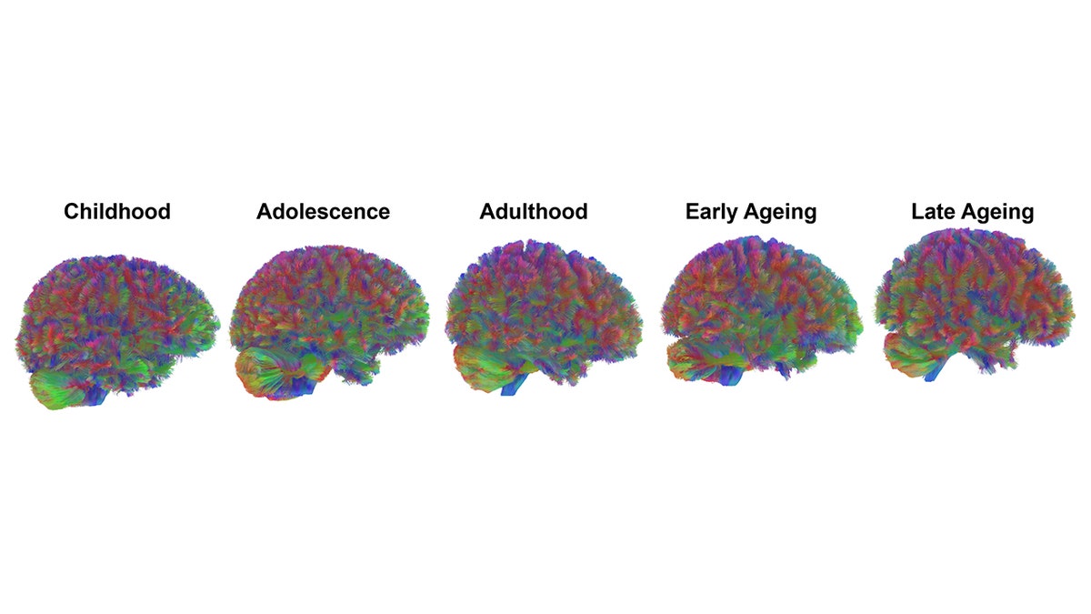 The five stages of brain development