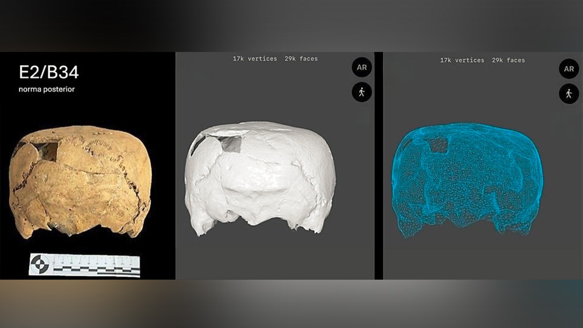 Head-on machine  scans of past  skull
