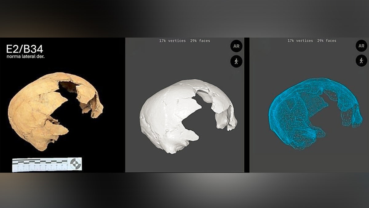 Pemindaian sisi tengkorak