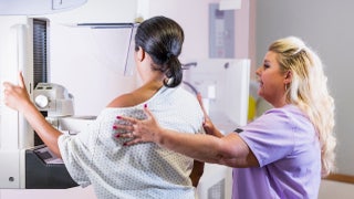 Shift in cancer screening guidance has experts clashing over new guidance