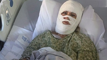 Georgia woman suffers severe burns after chemical attack during evening stroll - Fox News