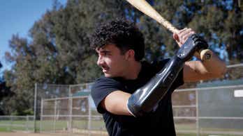 Bionic hand brings baseball star back to the field