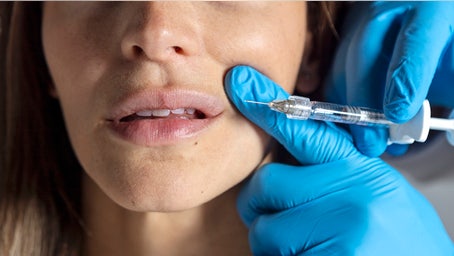 Cosmetic fillers can cause deadly complication, experts warn — but new tech exposes it