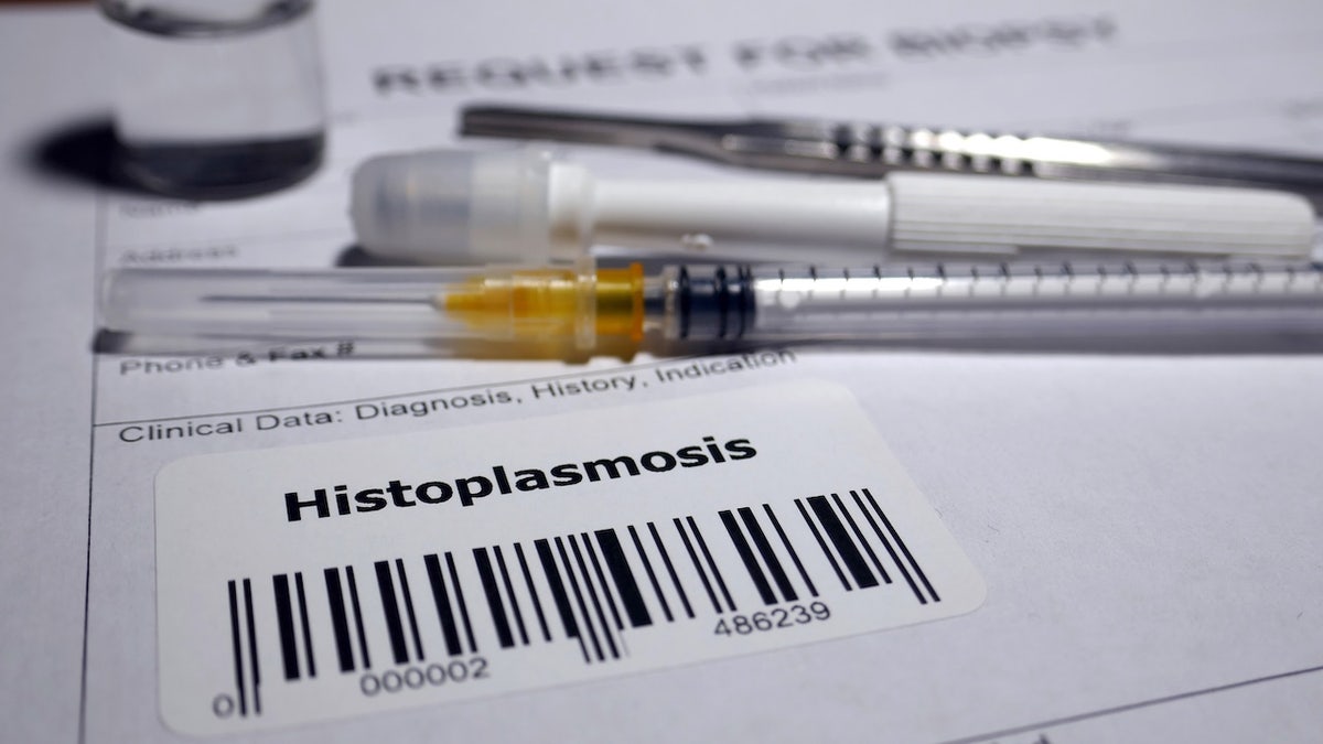 Test dell'istoplasmosi