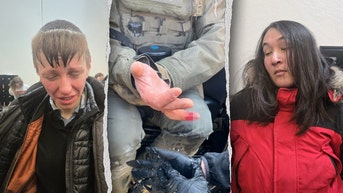 Anti-ICE agitator allegedly bites off federal officer's finger during Minneapolis attack - Fox News