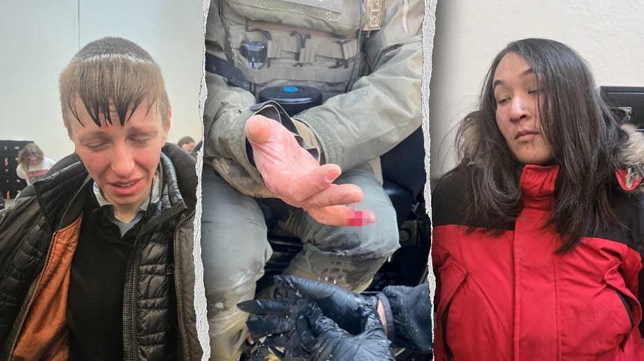 FINGER LOST: Savage Attack on ICE Officer in Minneapolis!