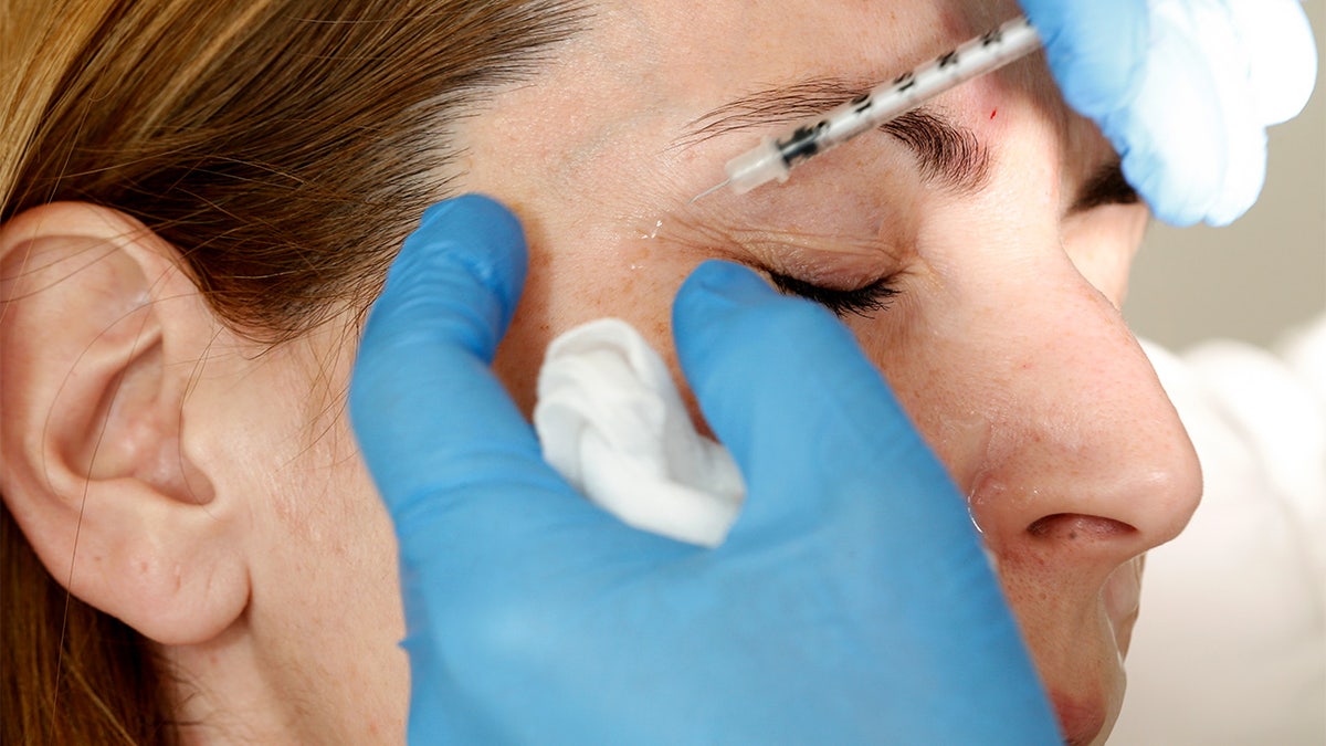 Injeção de Botox na área dos olhos